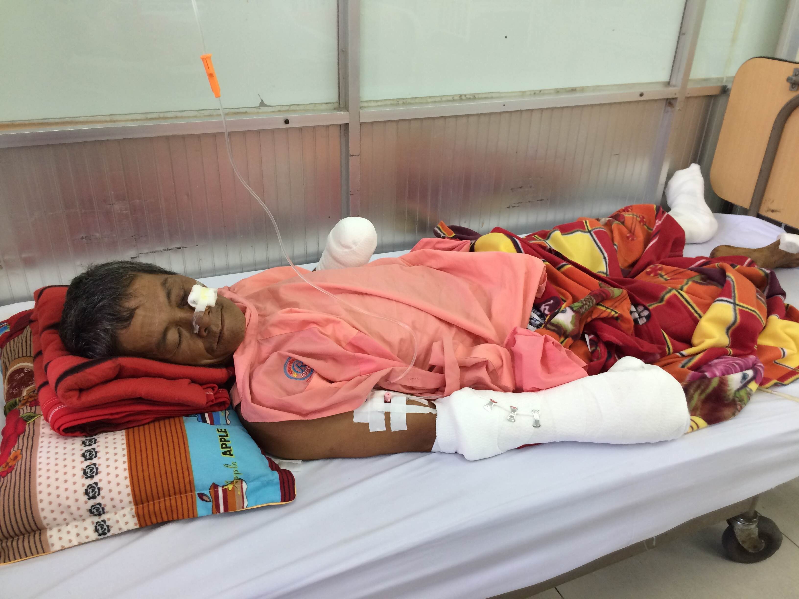 Cuoc trung min, hai cha con bi mat mot phan chan tay hinh anh