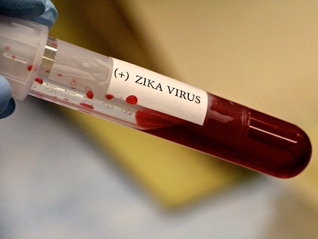 21 truong hop nhiem virus Zika, TP.HCM hop khan hinh anh