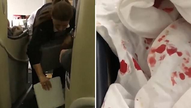 15 nguoi bi thuong khi xay ra hon loan nghiem trong tren may bay hinh anh