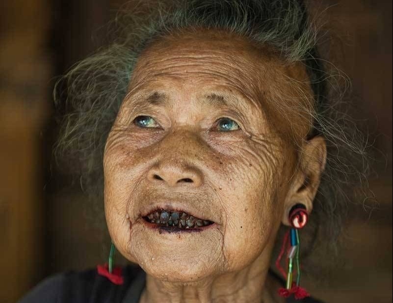 Noi nguoi dan giu tuc nhuom rang den hinh anh