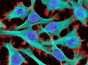 Cuoc doi bat tu cua Henrietta Lacks anh 2