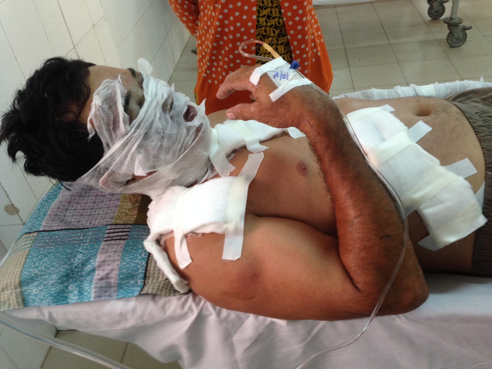 Vua buoc xuong oto, chu hang nuoc da bi tat ca axit vao mat hinh anh