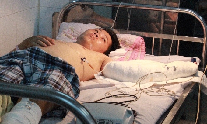 Uop da canh tay bi dut lia roi mang den benh vien hinh anh