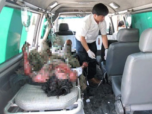 Go dieu tren duong day trung the, bi dien phong chay mat hinh anh