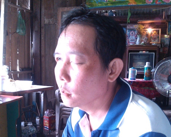 Tai xe xe tai khon kho vi nho rang bi mu mat hinh anh