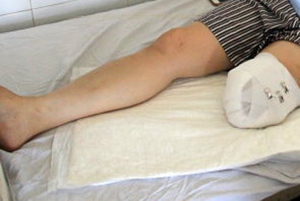 Nhan vien benh vien tu cat chan dem cat vao tu hinh anh