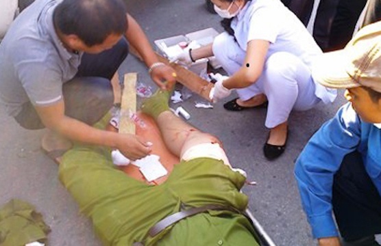 Pho cong an TP Sa Dec bi con nghien danh gay xuong hinh anh