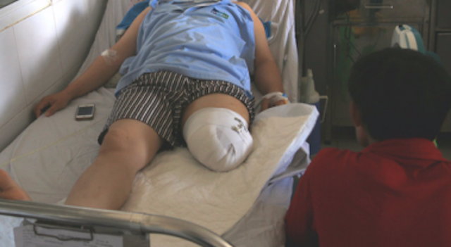 Chuyen nhan vien y te cat lia chan sang Benh vien tam than hinh anh