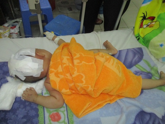 Be trai 15 thang tuoi vang khoi xe may, nut so hinh anh