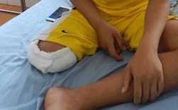 Benh nhan bi cat chan oan do benh vien yeu chuyen mon hinh anh