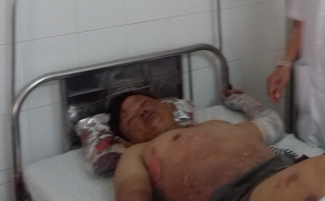 8 nguoi bong nang, do bep con phut chay tai tiec cuoi hinh anh