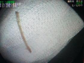 Hoc xuong vit dai 4 cm hinh anh