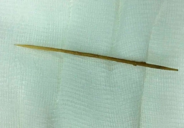 nuốt tăm xỉa răng ảnh 1 nuot tam xia rang anh 1