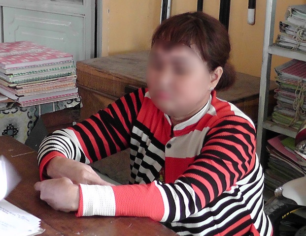 Xu phat nguoi phu nu hoang bao bi cuop 3,3 luong vang hinh anh
