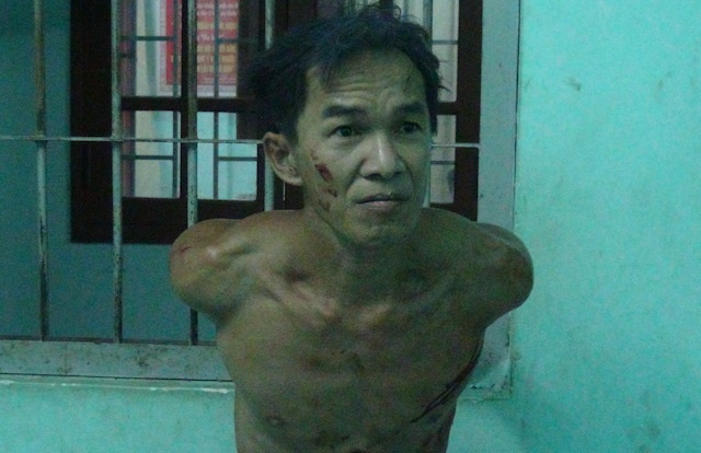 Nghi can giet nguoi, chem dut 2 ngon tay Truong cong an phuong hinh anh