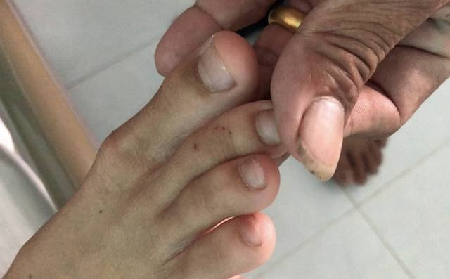 rắn cắn mùa nưới nổi ảnh 1 ran can mua nuoi noi anh 1