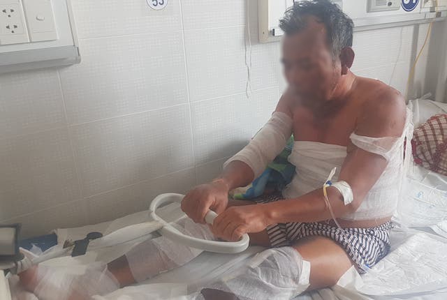 Hai vo chong o mien Tay bong khap nguoi vi khi gas ro ri hinh anh