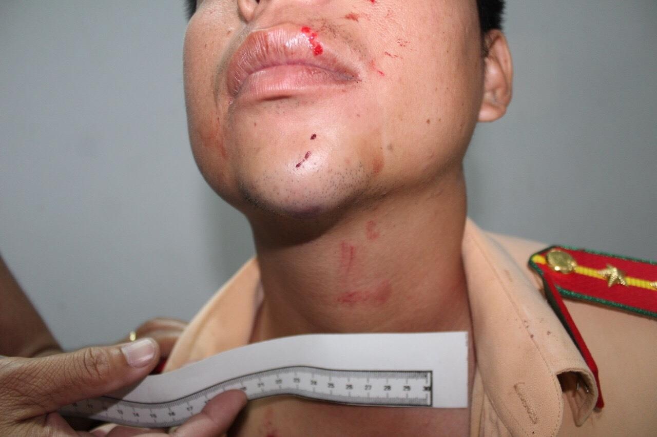 gia danh canh sat danh dai uy giao thong anh 2