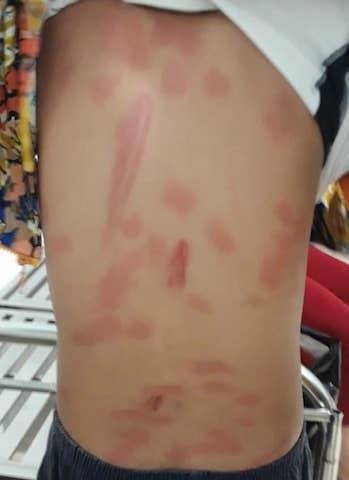 co ruot bao hanh nam sinh anh 1