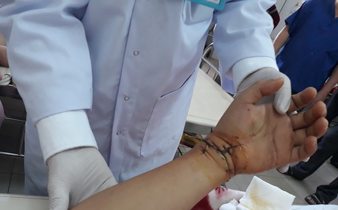 Khoi to 9X chem lia tay nguoi khac hinh anh