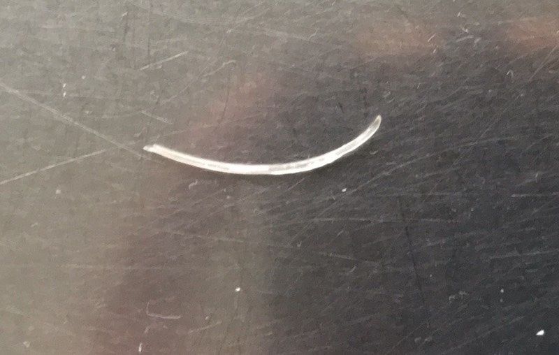 Nguoi dan ong bi xuong ca dam thung thuc quan anh 1