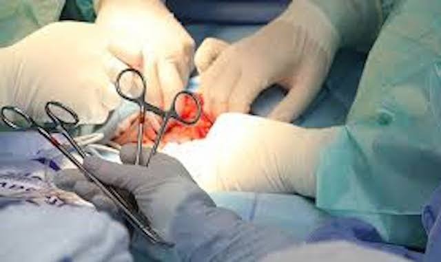 Chong bi vo cat 'cua quy' luc nua dem hinh anh