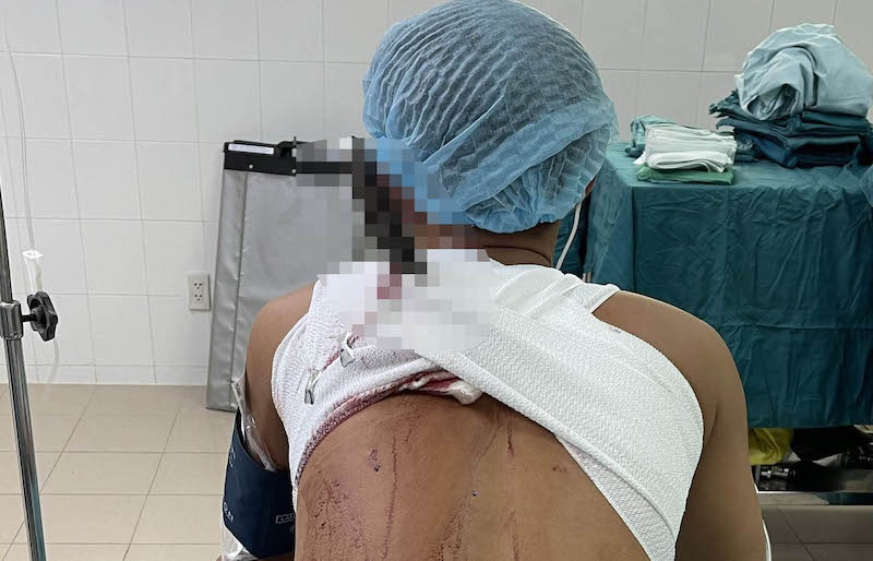 Nam thanh nien bi dam thau lung sau tiec nhau hinh anh