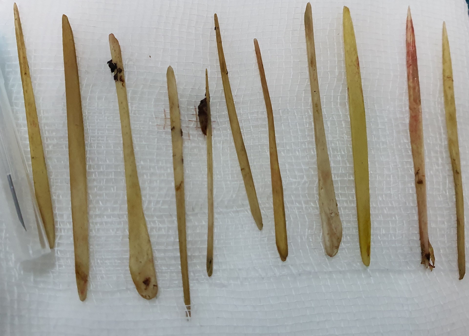 Nuot 11 que tam xia rang, nguoi dan ong bi thung ruot hinh anh