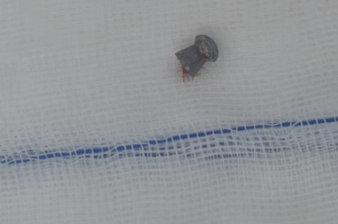 Cuu song nam thanh nien bi ban thung bung anh 2