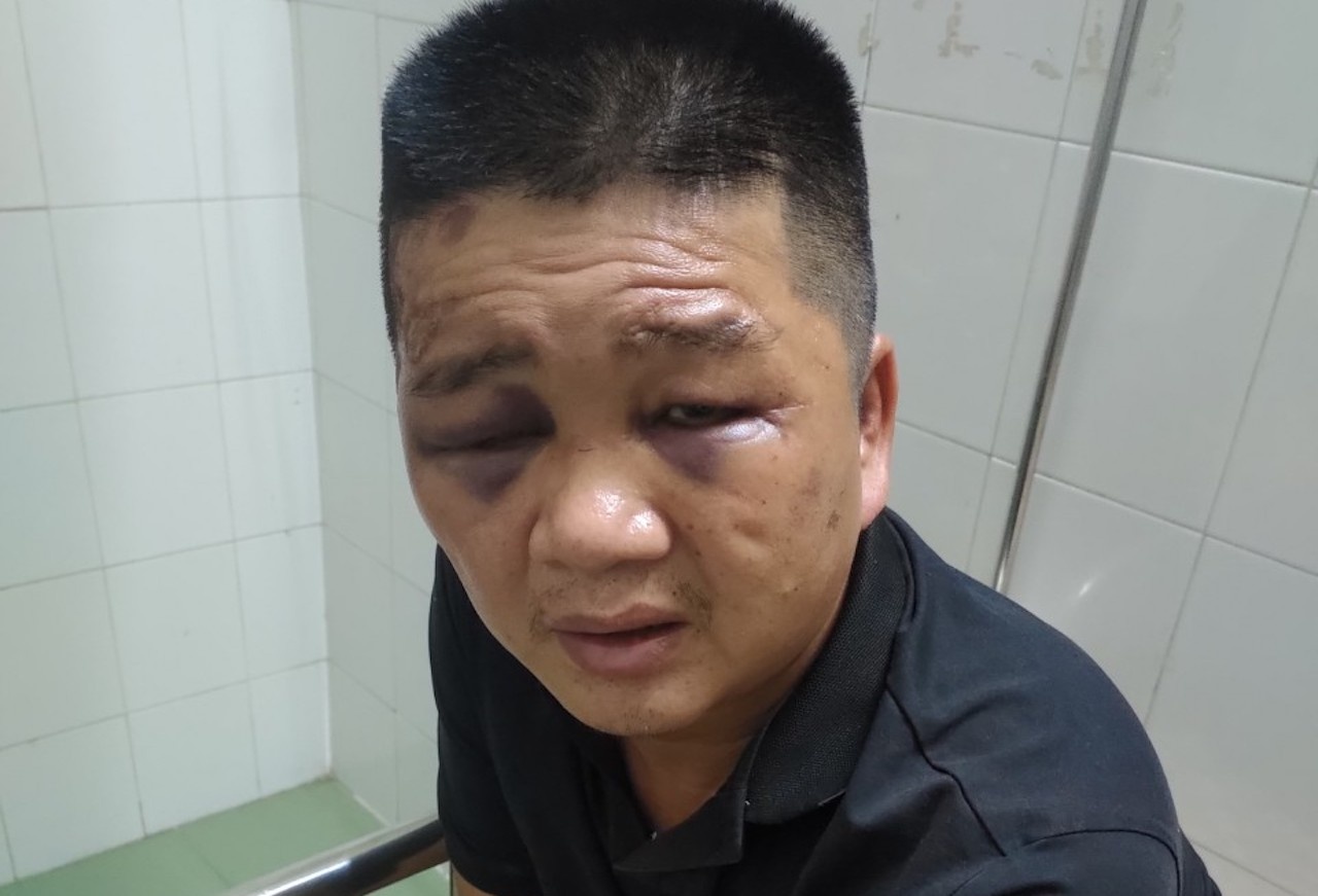 Moc cop xe trom 100 trieu dong hinh anh