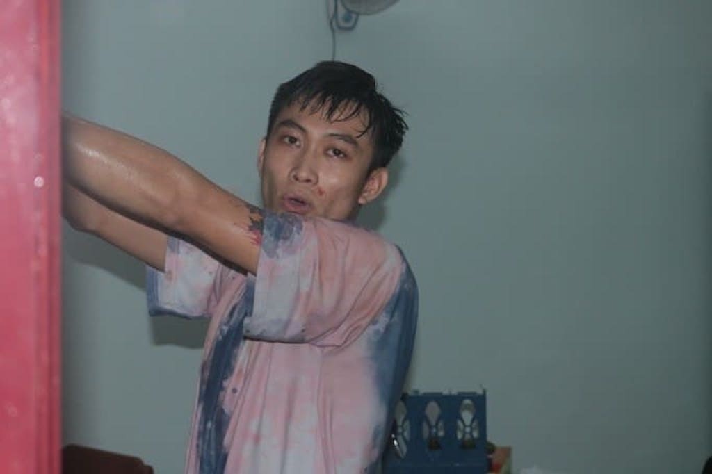 Thanh nien ngao da chem 3 nguoi bi thuong hinh anh