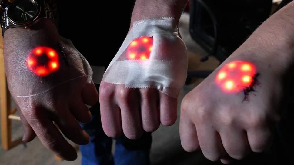 Cay chip vao co the nguoi ngay mot pho bien hinh anh