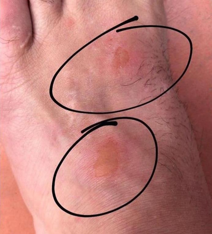 Tai nạn khi bơi ở hồ nước độc hại ảnh 4 Tai nan khi boi o ho nuoc doc hai anh 4