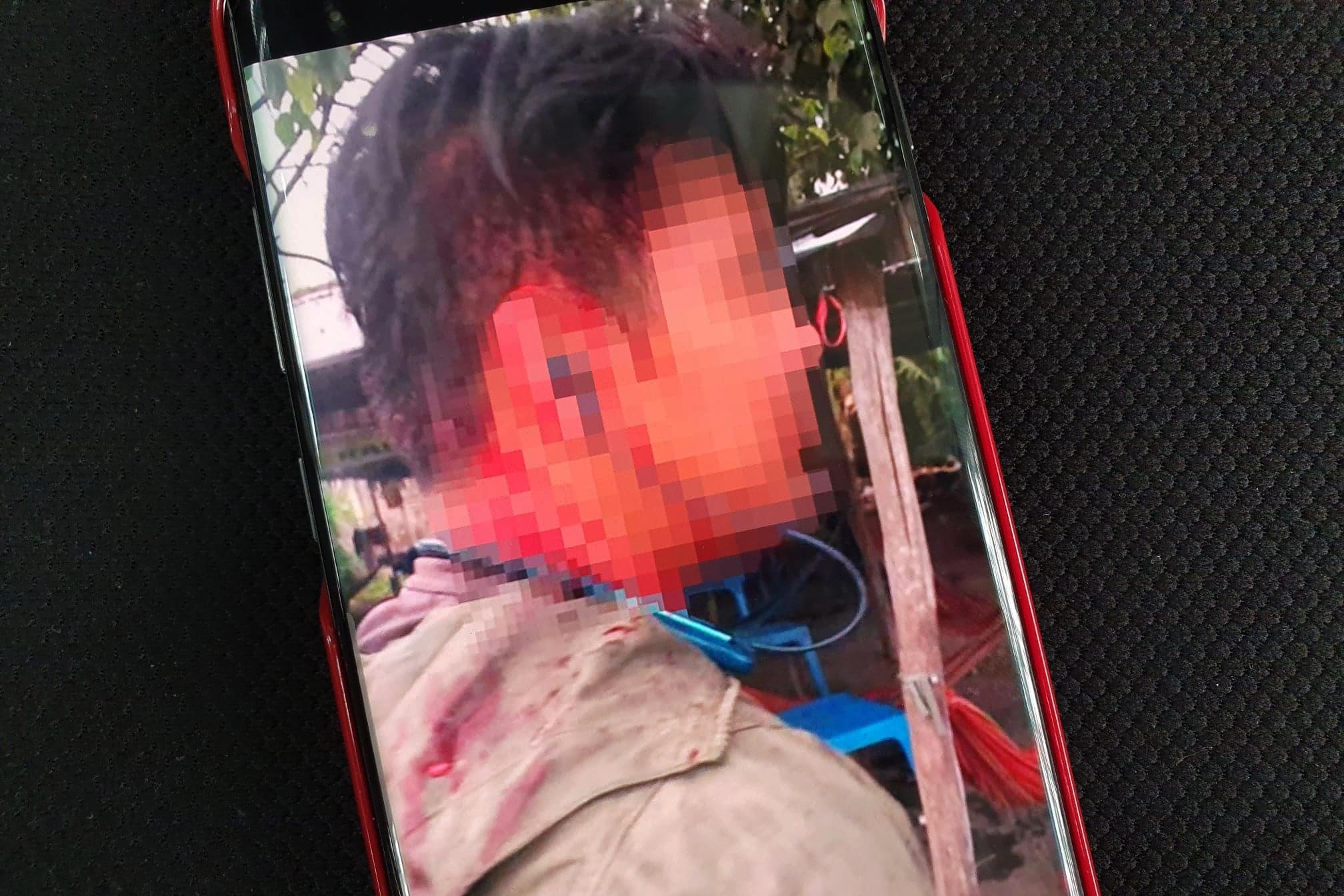 Vo nan nhan bi danh o quan an nghi chat chem: 'Chung toi chua kien gi' hinh anh