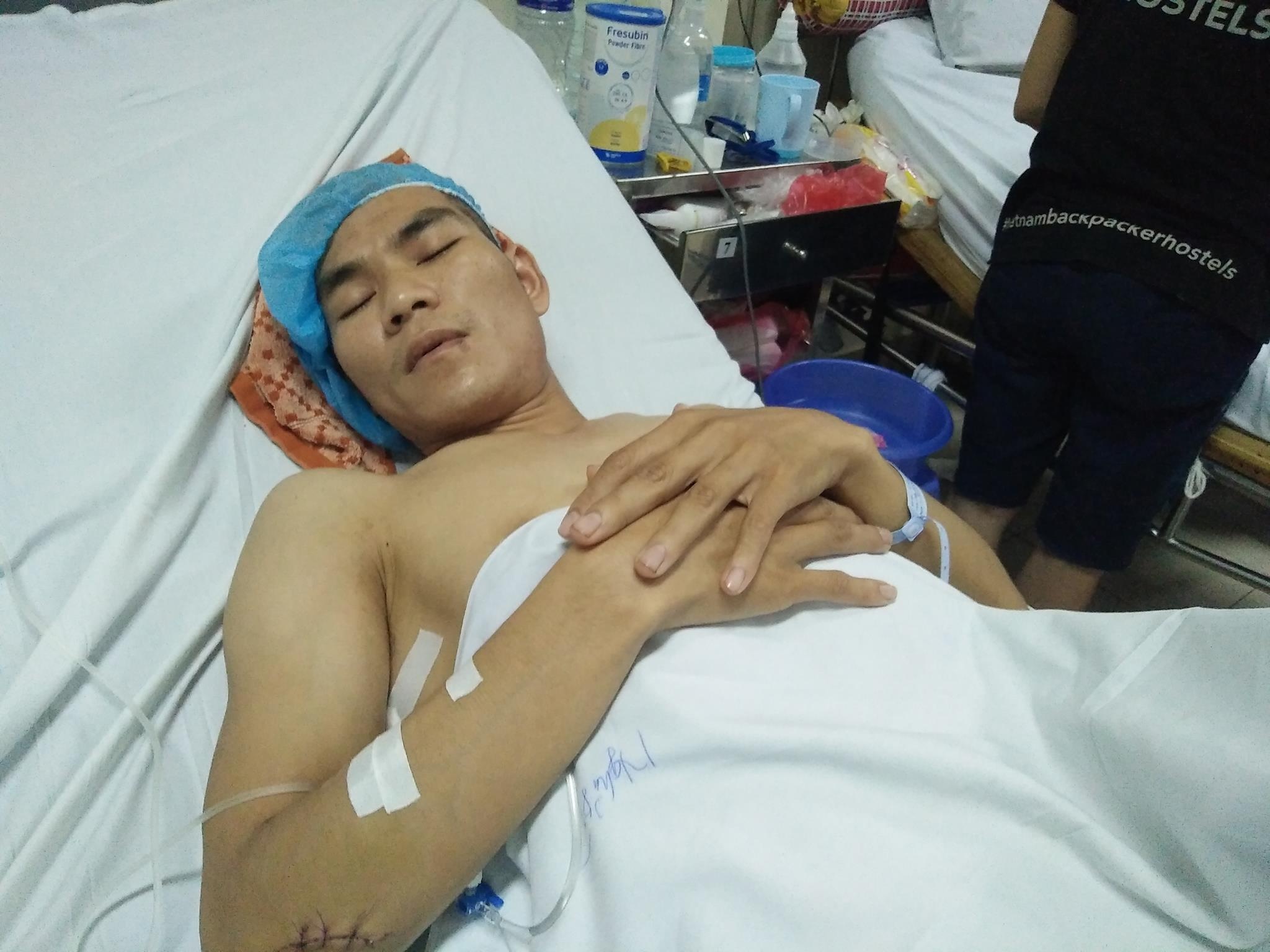 Bị chém vì đi tiểu bậy ảnh 1 Bi chem vi di tieu bay anh 1