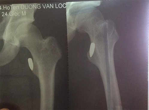 Vận động viên Pencak Silat ảnh 1 Van dong vien Pencak Silat anh 1