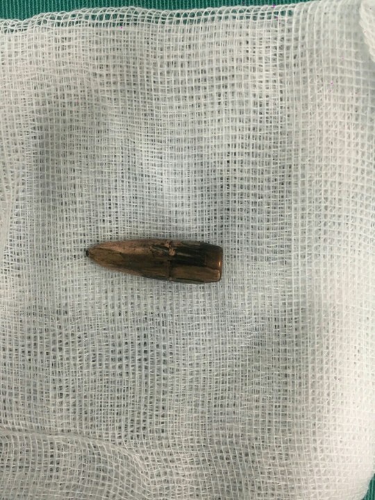 Dan lac gam vao nguc anh 2