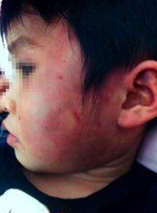 Be gai 4 tuoi bi bam tim toan than la do 'bi ban danh' hinh anh