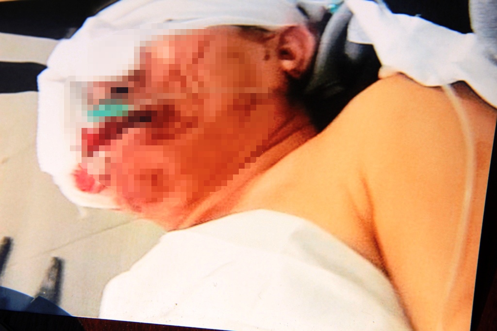 Viet kieu bi giang ho chem dut 3 ngon tay truoc cong nha hinh anh