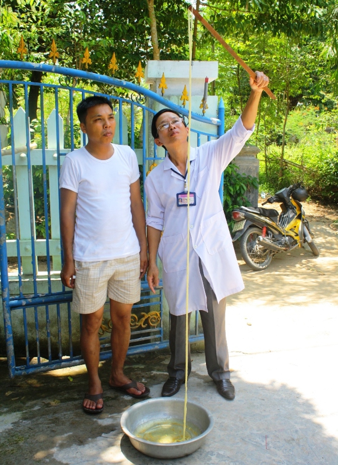 Sán xơ mít dài hơn 12 m nằm trong ruột người. Ảnh: Điền Quang.