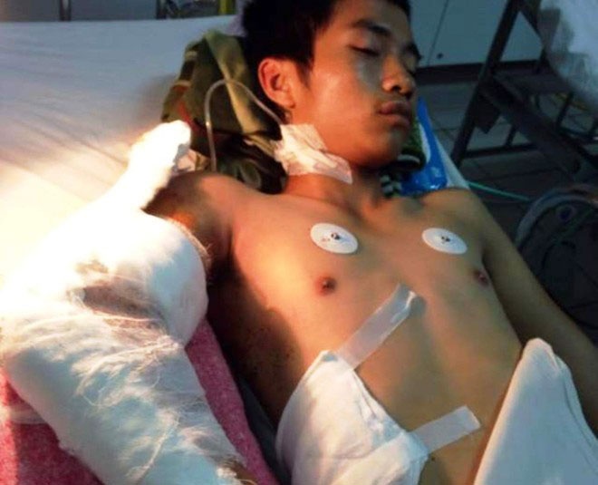 Dua nhom con do chem roi canh tay nam thanh nien ra xet xu hinh anh