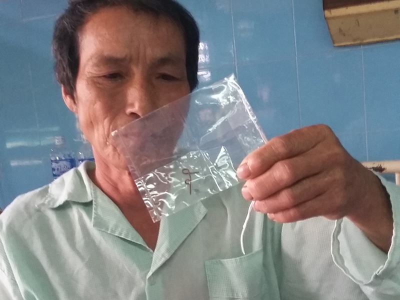 Phau thuat gap soi day dong 4 cm di lac vao phe quan hinh anh