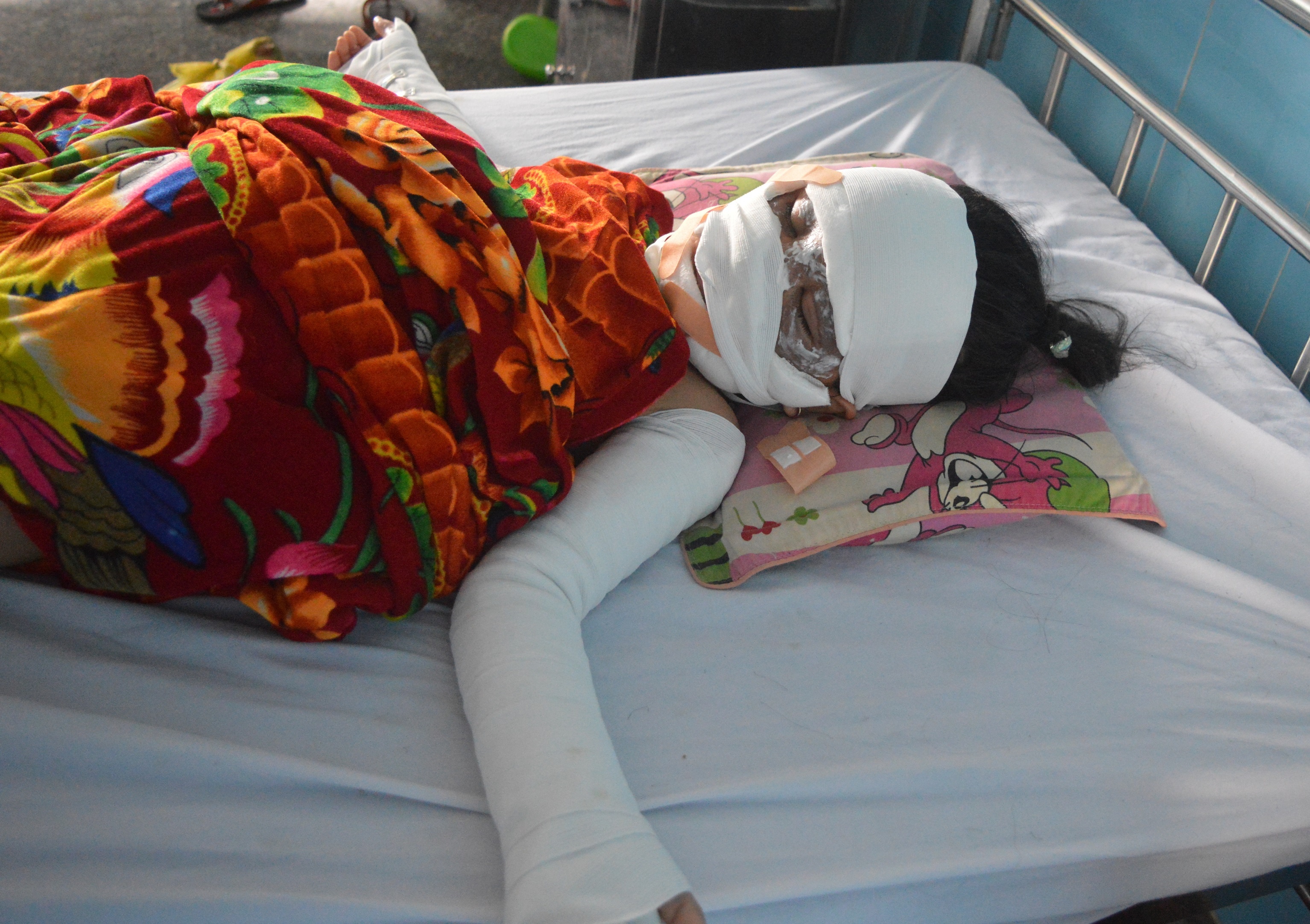 Nan nhan vu no bong bay dem Trung thu qua con nguy kich hinh anh