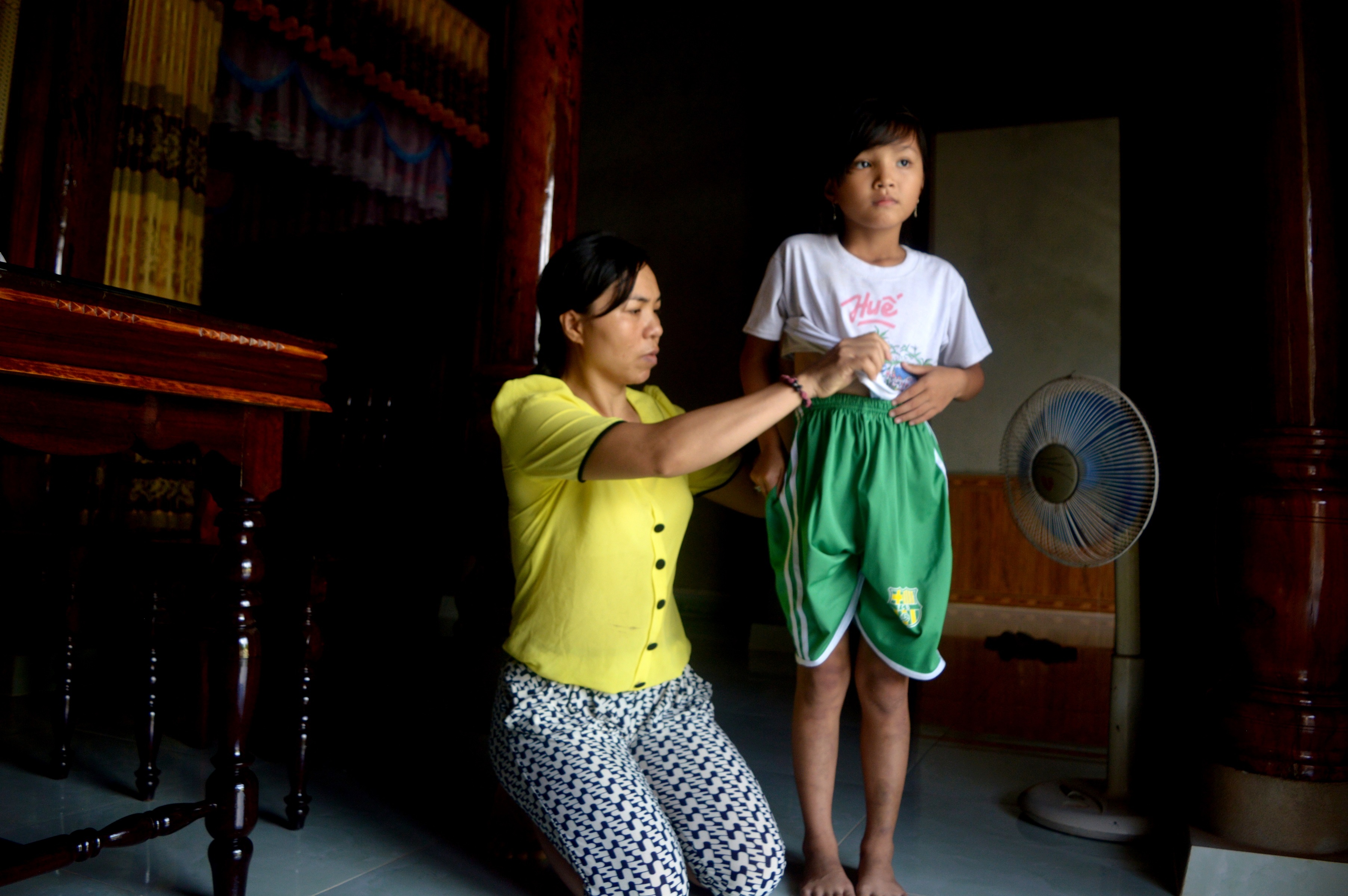 Be gai 8 tuoi bi cha danh nhap vien anh 1