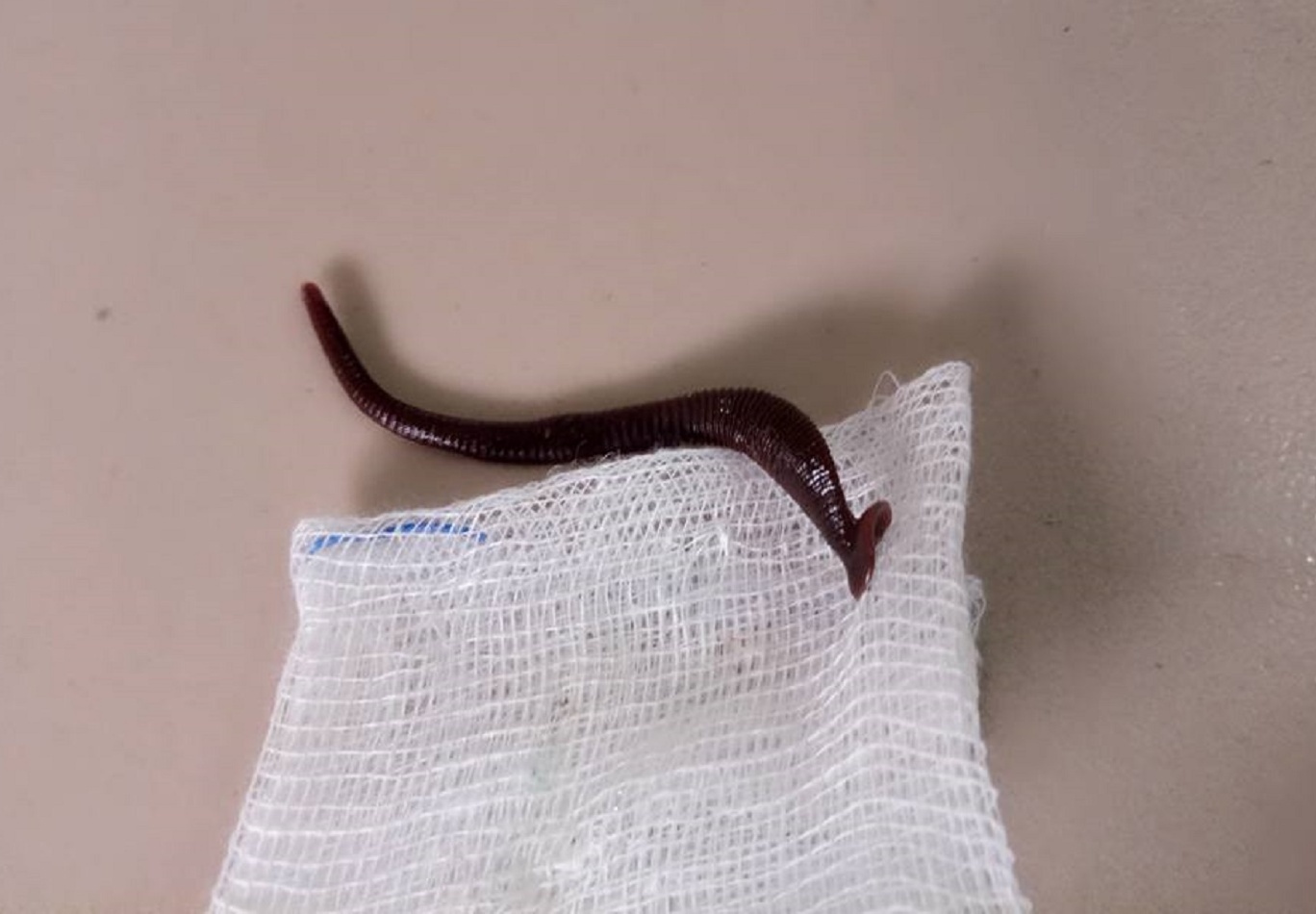 Vắt dài 5 cm trong hốc mũi bé gái ảnh 1 Vat dai 5 cm trong hoc mui be gai anh 1