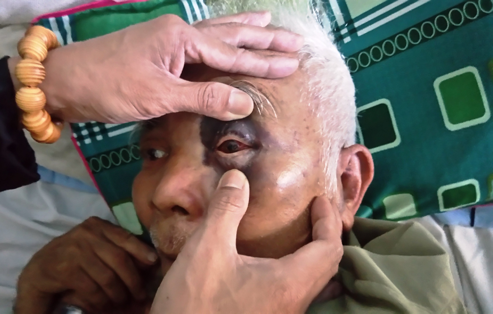 Thay giao vuong lao ly vi danh vo chong gia nhap vien hinh anh