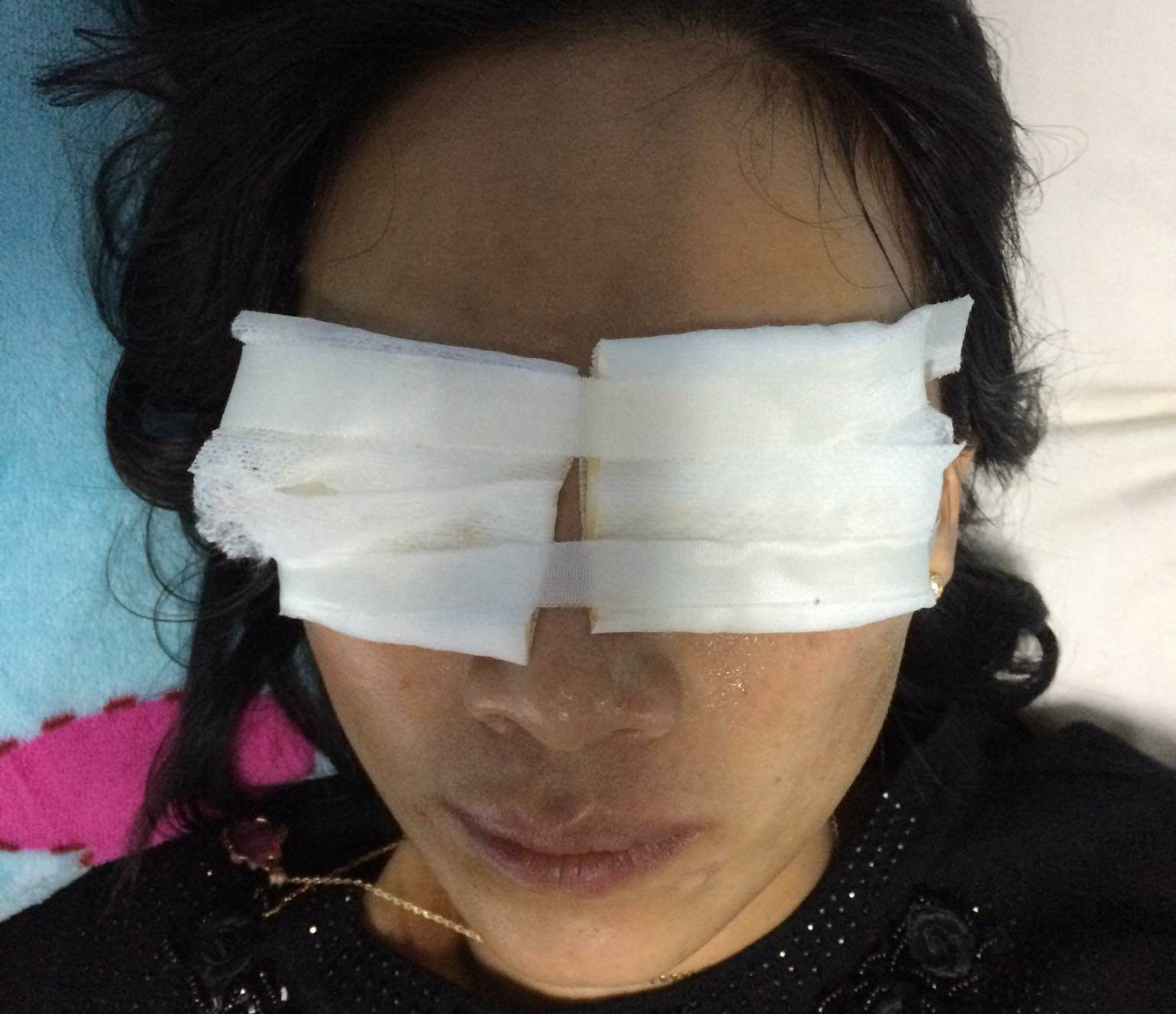 Ba chu tiem vang tat axit vao mat con dau hinh anh