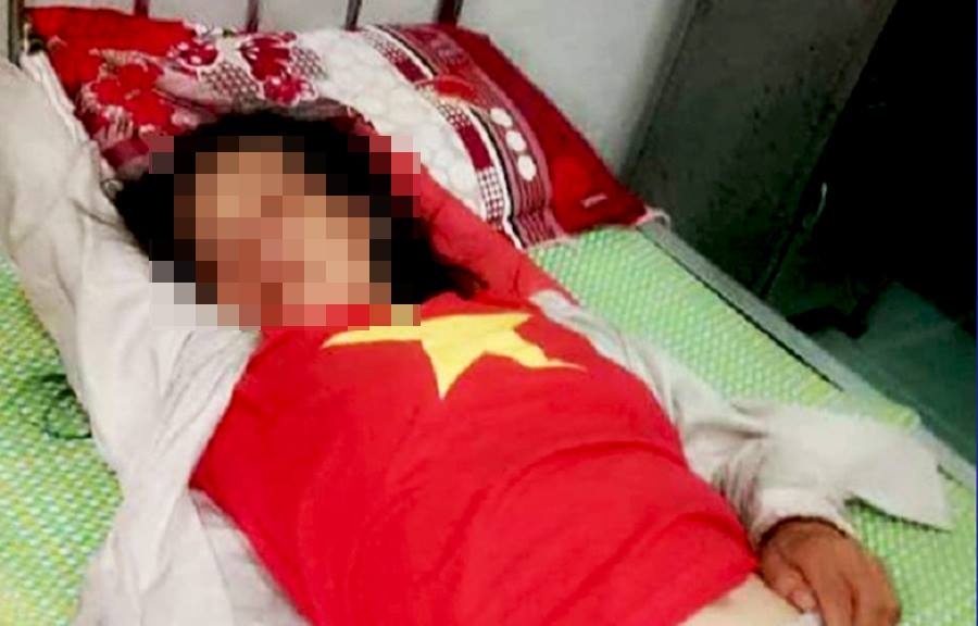 Bi tinh nghi bat coc tre em, mot phu nu tam than bi danh bam minh hinh anh
