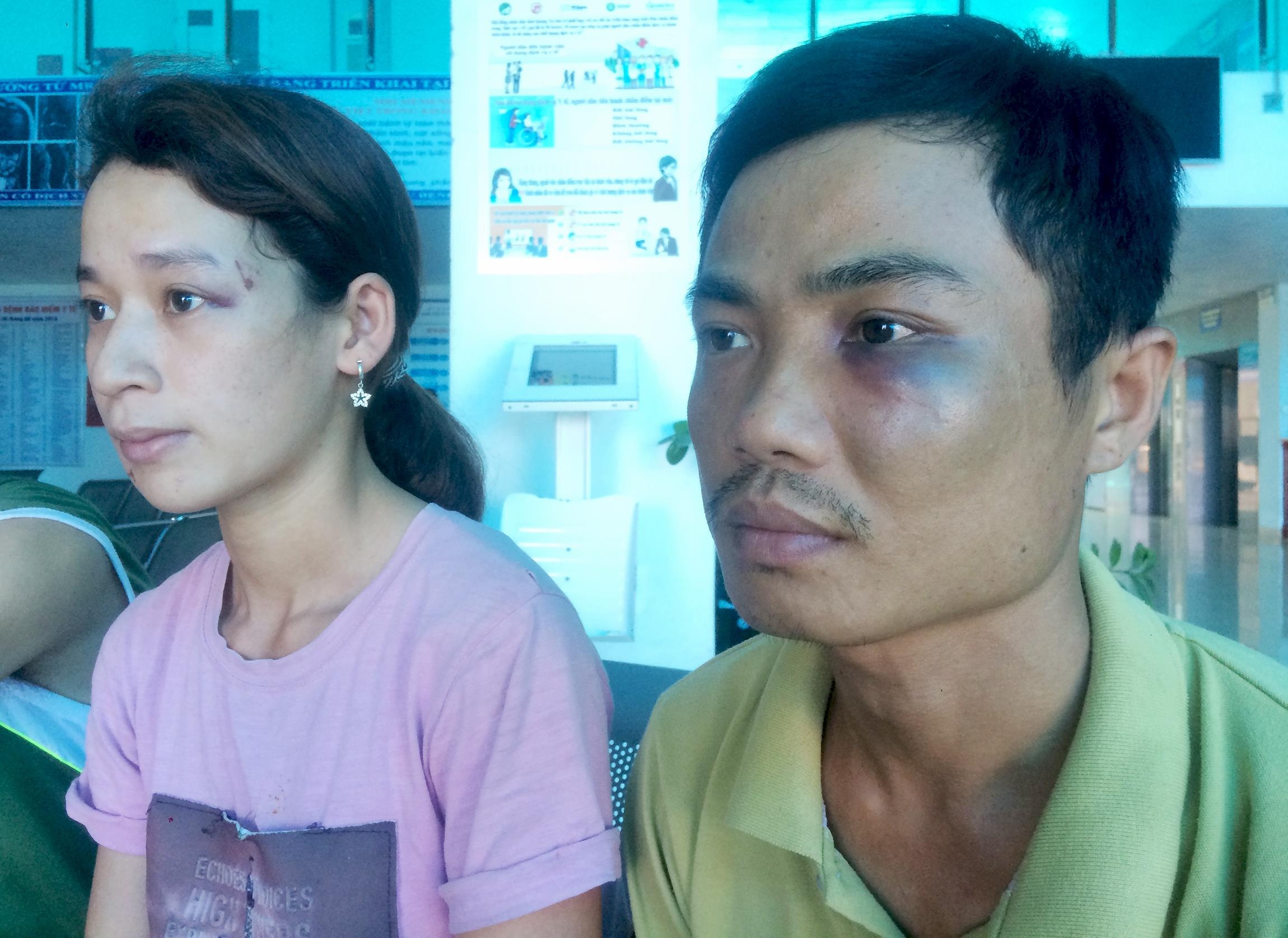 3 nguoi bat cap vo chong quy giua nang bi tam giam hinh anh