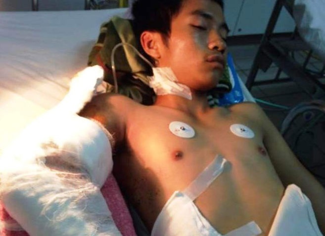 Thanh nien bi chem roi canh tay la het o benh vien hinh anh